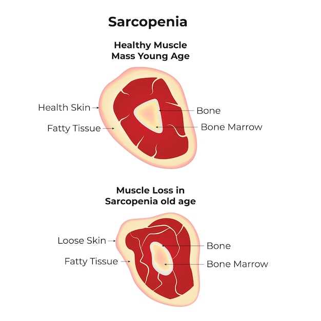 Overview of hemangioma