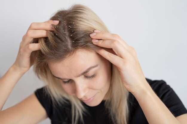 Propranolol chute de cheveux